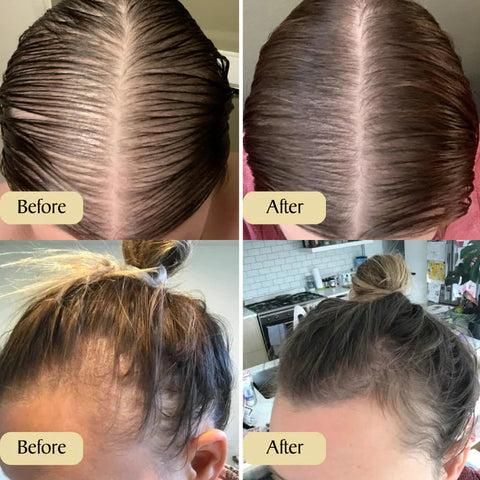 Vegan Natural Hair Growth Oil (1+1 Free)